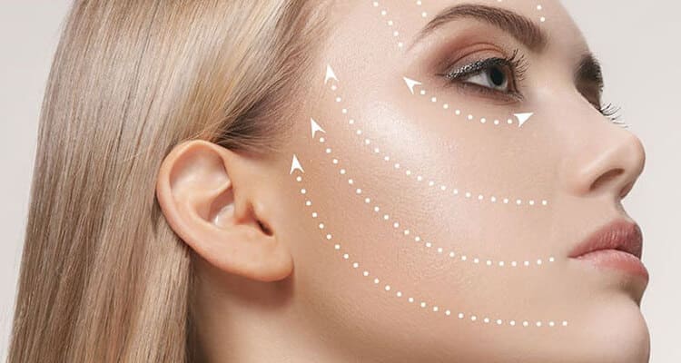 Lifting del viso (Ritidectomia)